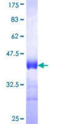 SDS-PAGE: Recombinant Human MARCKS GST (N-Term) Protein [H00004082-Q01]