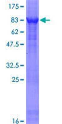 SDS-PAGE: Recombinant Human Mad GST (N-Term) Protein [H00004084-P01]