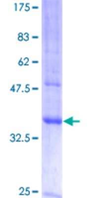 SDS-PAGE: Recombinant Human MAL GST (N-Term) Protein [H00004118-P01]