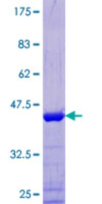 SDS-PAGE: Recombinant Human MAP4 GST (N-Term) Protein [H00004134-P01]