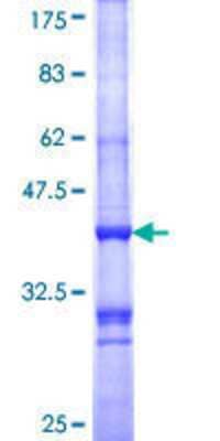 SDS-PAGE: Recombinant Human Melanocortin-1 R/MC1R GST (N-Term) Protein [H00004157-Q01]