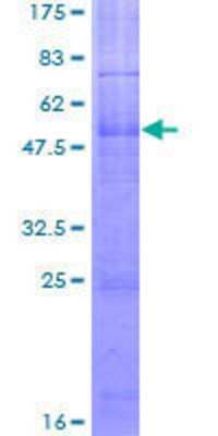 SDS-PAGE: Recombinant Human Melanocortin-2 R/MC2R GST (N-Term) Protein [H00004158-P01]