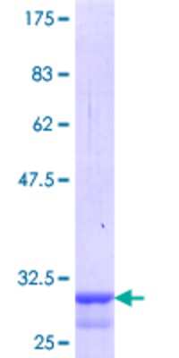 SDS-PAGE: Recombinant Human Melanocortin-4 R GST (N-Term) Protein [H00004160-Q01]