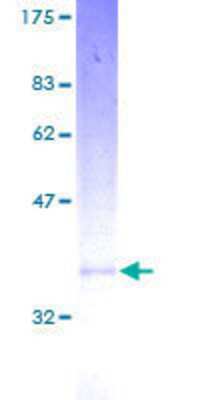 SDS-PAGE: Recombinant Human MGST3 GST (N-Term) Protein [H00004259-P01]