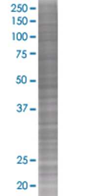 Other: MMP-8 293T Cell Transient Overexpression Lysate [H00004317-T01]