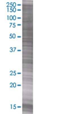 Other: MOG 293T Cell Transient Overexpression Lysate [H00004340-T01]