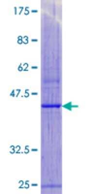 SDS-PAGE: Recombinant Human MPV17 GST (N-Term) Protein [H00004358-P01]