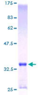 SDS-PAGE: Recombinant Human Metallothionein-1E GST (N-Term) Protein [H00004493-P01]