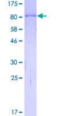 SDS-PAGE: Recombinant Human MYBPH GST (N-Term) Protein [H00004608-P01]