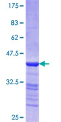 SDS-PAGE: Recombinant Human Myosin Heavy Chain 3 GST (N-Term) Protein [H00004621-Q01]