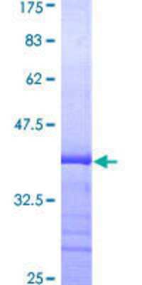 SDS-PAGE: Recombinant Human non-muscle Myosin IIA GST (N-Term) Protein [H00004627-Q01]