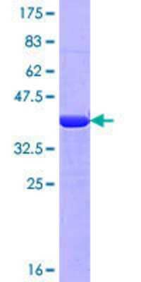 SDS-PAGE: Recombinant Human non-muscle Myosin IIA GST (N-Term) Protein [H00004627-Q02]