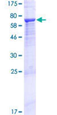 SDS-PAGE: Recombinant Human Myosin-Id GST (N-Term) Protein [H00004642-P01]