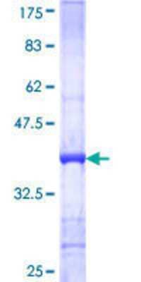 SDS-PAGE: Recombinant Human Myosin VIIa GST (N-Term) Protein [H00004647-Q01]