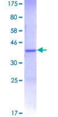 SDS-PAGE: Recombinant Human MYO9B GST (N-Term) Protein [H00004650-Q01]