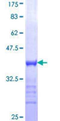 SDS-PAGE: Recombinant Human Myt1 GST (N-Term) Protein [H00004661-Q01]