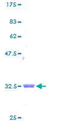 SDS-PAGE: Recombinant Human NDUFB1 GST (N-Term) Protein [H00004707-P01]