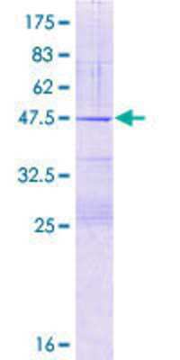 SDS-PAGE: Recombinant Human NDUFB7 GST (N-Term) Protein [H00004713-P01]