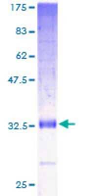 SDS-PAGE: Recombinant Human NF2/Merlin GST (N-Term) Protein [H00004771-P01]