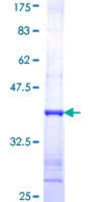 SDS-PAGE: Recombinant Human iNOS GST (N-Term) Protein [H00004843-Q01]