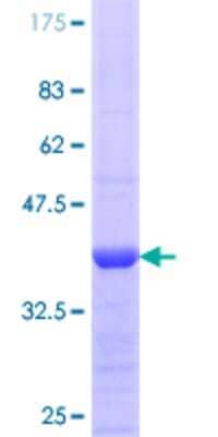 SDS-PAGE: Recombinant Human eNOS GST (N-Term) Protein [H00004846-Q01]