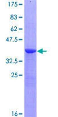 SDS-PAGE: Recombinant Human Nephronophthisis GST (N-Term) Protein [H00004867-P01]