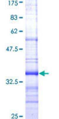 SDS-PAGE: Recombinant Human NPY1R GST (N-Term) Protein [H00004886-Q01]