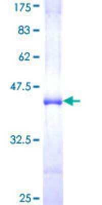 SDS-PAGE: Recombinant Human NUP98 GST (N-Term) Protein [H00004928-Q01]