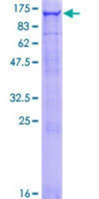 SDS-PAGE: Recombinant Human OCRL GST (N-Term) Protein [H00004952-P01]