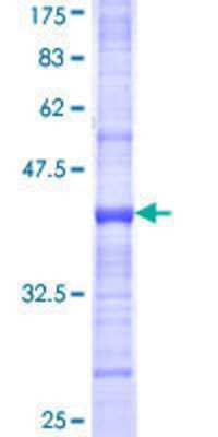 SDS-PAGE: Recombinant Human ORC1 GST (N-Term) Protein [H00004998-Q01]