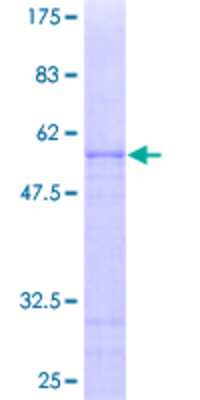 SDS-PAGE: Recombinant Human OVOL1 GST (N-Term) Protein [H00005017-P01]