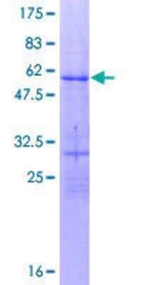 SDS-PAGE: Recombinant Human OVOL1 GST (N-Term) Protein [H00005017-P02]