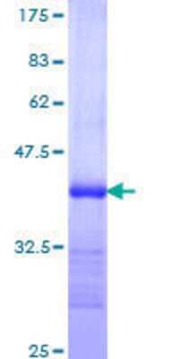 SDS-PAGE: Recombinant Human PACE4/PCSK6 GST (N-Term) Protein [H00005046-Q01]