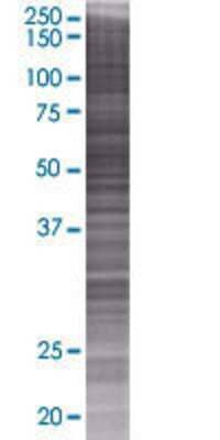 Other: PCCB 293T Cell Transient Overexpression Lysate [H00005096-T01]