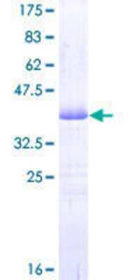 SDS-PAGE: Recombinant Human PDE3A GST (N-Term) Protein [H00005139-Q01]