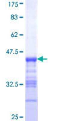 SDS-PAGE: Recombinant Human PDE3B GST (N-Term) Protein [H00005140-Q01]