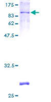 SDS-PAGE: Recombinant Human Phosphodiesterase 4D GST (N-Term) Protein [H00005144-P01]