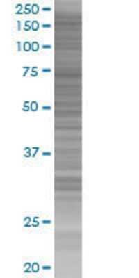 Other: PDGFR alpha 293T Cell Transient Overexpression Lysate [H00005156-T01]