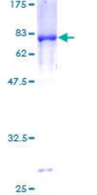 SDS-PAGE: Recombinant Human Pyruvate Dehydrogenase E1-alpha subunit GST (N-Term) Protein [H00005160-P01]