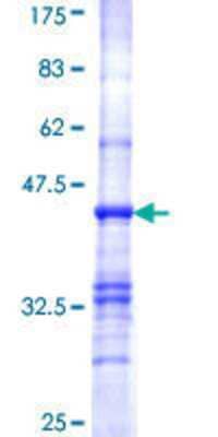 SDS-PAGE: Recombinant Human Pyruvate Dehydrogenase E1 beta subunit GST (N-Term) Protein [H00005162-Q01]