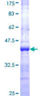 SDS-PAGE: Recombinant Human ENPP-3/CD203c GST (N-Term) Protein [H00005169-Q01]