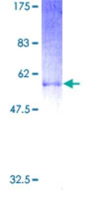 SDS-PAGE: Recombinant Human Proenkephalin GST (N-Term) Protein [H00005179-P01]