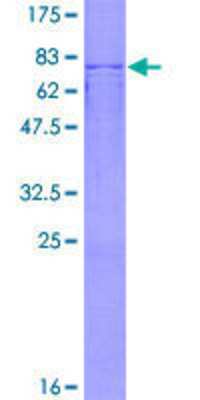 SDS-PAGE: Recombinant Human PFKFB2 GST (N-Term) Protein [H00005208-P01]