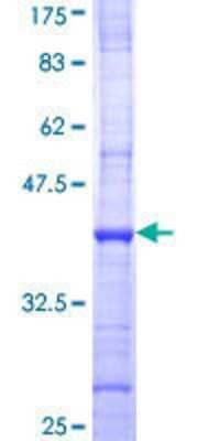 SDS-PAGE: Recombinant Human PFKFB4 GST (N-Term) Protein [H00005210-Q01]