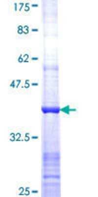 SDS-PAGE: Recombinant Human PFKL GST (N-Term) Protein [H00005211-Q01]