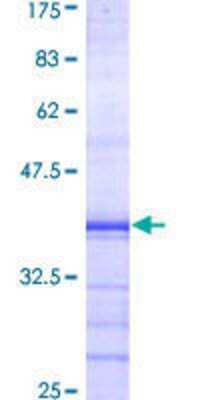 SDS-PAGE: Recombinant Human Polycystin 2 GST (N-Term) Protein [H00005311-Q01]