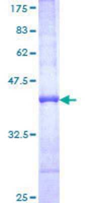 SDS-PAGE: Recombinant Human Plectin GST (N-Term) Protein [H00005339-Q01]