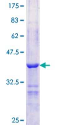 SDS-PAGE: Recombinant Human Perilipin GST (N-Term) Protein [H00005346-Q01]