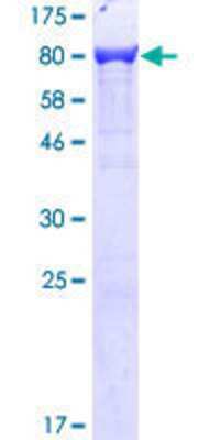 SDS-PAGE: Recombinant Human T Plastin GST (N-Term) Protein [H00005358-P01]