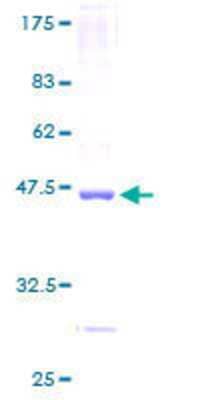 SDS-PAGE: Recombinant Human Noxa GST (N-Term) Protein [H00005366-P01]